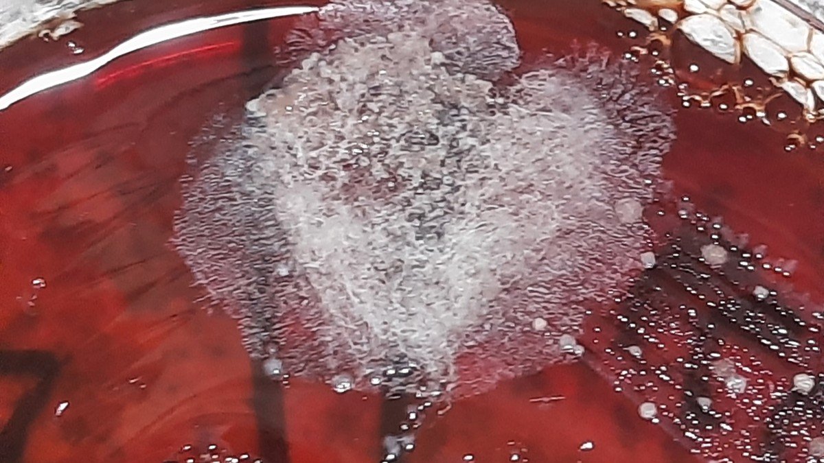 Microscopic visualization of drug-resistant bacteria alongside medical laboratory equipment
